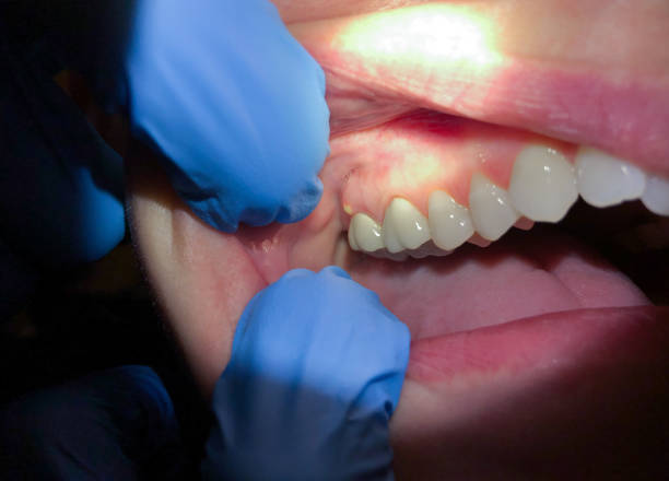 Best Emergency Gum Pain Relief  in Cochituate, MA